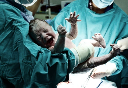 Expert Legal Representation for Families Impacted by Birth Injuries